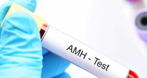 AMH Hormonu