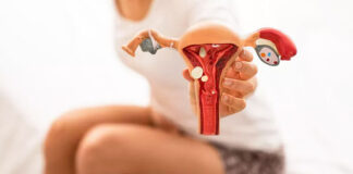 kıbrıs endometriozis tedavisi