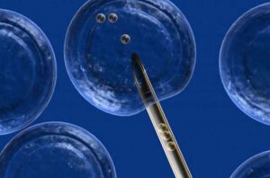 Embriyo Transferi Sonrası Kanama Ve Nedenleri