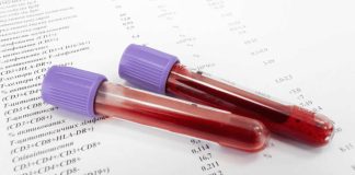 AMH Testi Nedir, Ne Zaman Yapılır?
