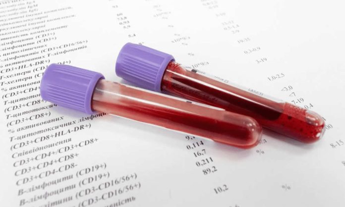 AMH testi AMH Testi Nedir, Ne Zaman Yapılır?