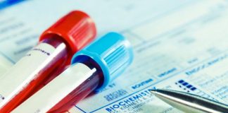 AFP Testi (Alfa FetoProtein) Nedir