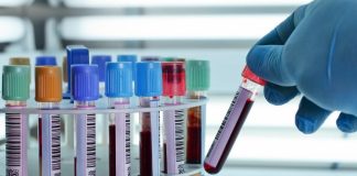Kan Uyuşmazlığı Testi