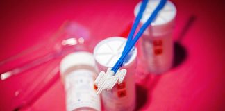 Smear Testi Nedir