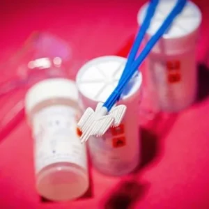 Smear Testi Nedir